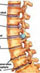 Spinal problems can lead to visceral dysfunction