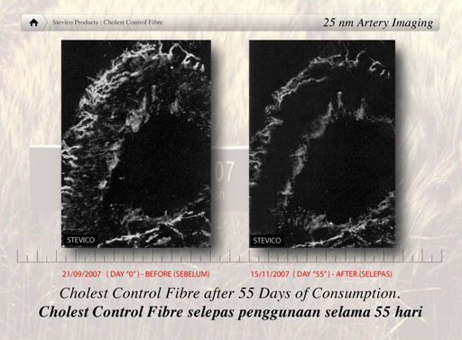 Stevico Cholesterol Control Fibre